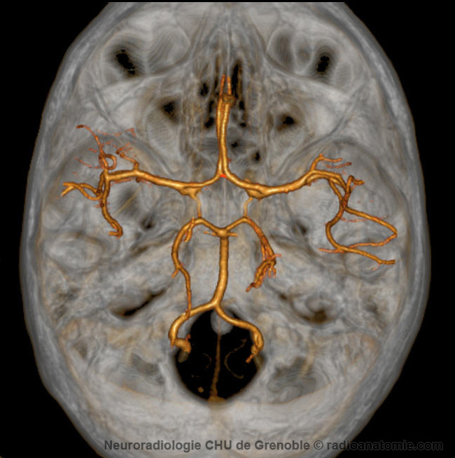 Polygone de Willis - Anastomoses : Artre Communicante antrieure